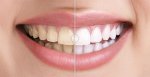 Before & After Images Comparison WordPress Plugin.jpg
