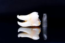 tooth-model-implant-black-background-art-photo-dental-concept.jpg